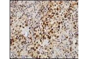 Immunohistochemistry (IHC) image for anti-Epstein-Barr Virus (EBV) (C-Term) antibody (ABIN870470) (EBV 抗体  (C-Term))