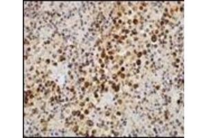 Immunohistochemistry (IHC) image for anti-Epstein-Barr Virus (EBV) (C-Term) antibody (ABIN870471) (EBV 抗体  (C-Term))