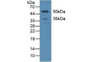 Detection of CD299 in Human Serum using Polyclonal Antibody to Cluster Of differentiation 299 (CD299) (C-Type Lectin Domain Family 4, Member M (CLEC4M) (AA 242-399) 抗体)