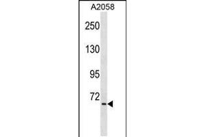 Western blot analysis in A2058 cell line lysates (35ug/lane). (TNIP1 抗体  (C-Term))