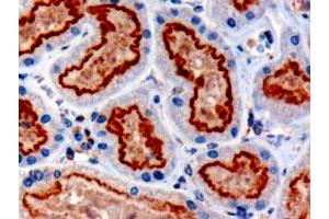 IFT88 polyclonal antibody  (3 ug/mL) staining of paraffin embedded human kidney. (IFT88 抗体  (C-Term))