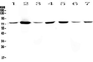 Western Blotting (WB) image for anti-Annexin A6 (ANXA6) (AA 395-665) antibody (ABIN5692982)