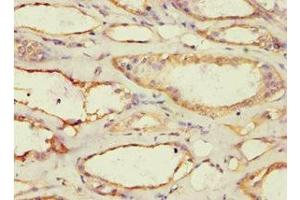 Immunohistochemistry of paraffin-embedded human kidney tissue using ABIN7142945 at dilution of 1:100 (ACAT1 抗体  (AA 1-145))