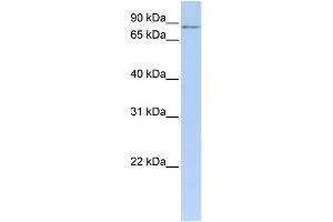 WB Suggested Anti-MTO1 Antibody Titration: 0. (MTO1 抗体  (N-Term))