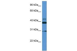 Western Blot showing VASP antibody used at a concentration of 1 ug/ml against Fetal Heart Lysate (VASP 抗体  (Middle Region))