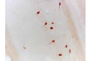 Formalin-fixed and paraffin embedded chicken testis tissue labeled with Anti-Neurturin Polyclonal Antibody, Unconjugated (ABIN724505) 1:200 followed by conjugation to the secondary antibody and DAB staining