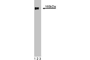 Western blot analysis of Desmoglein on a HeLa cell lysate (Human cervical epitheloid carcinoma, ATCC CCL-2. (Desmoglein (AA 705-1029) 抗体)