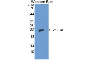 Western blot analysis of the recombinant protein. (Thimet Oligopeptidase 1 抗体  (AA 451-597))