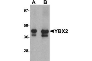 Western blot analysis of YBX2 in human testis tissue lysate with YBX2 antibody at (A) 1 and (B) 2 μg/ml. (YBX2 抗体  (C-Term))