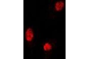 Immunofluorescent analysis of Sox-5 staining in U2OS cells. (SOX5 抗体)
