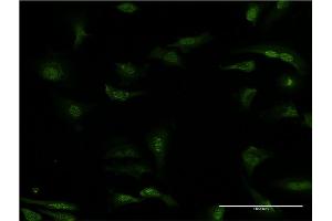 Immunofluorescence of monoclonal antibody to PDE5A on HeLa cell. (PDE5A 抗体  (AA 29-138))