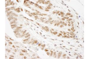 Immunohistochemistry (IHC) image for anti-Wilms Tumor 1 Associated Protein (WTAP) (AA 346-396) antibody (ABIN7449036)