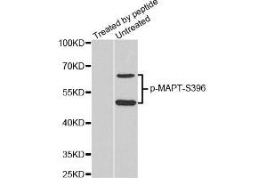 Western Blotting (WB) image for anti-Microtubule-Associated Protein tau (MAPT) (pSer396) antibody (ABIN3019683) (MAPT 抗体  (pSer396))