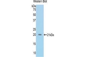 Western blot analysis of the recombinant protein. (ACVR2A 抗体  (AA 326-485))