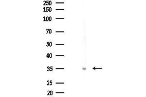 Western blot analysis of lysates from A2780 cells(starvation 24h treatment), using Stanniocalcin 1 Antibody at 1/1000 dilution.
