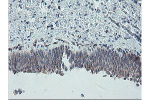 Image no. 11 for anti-Carboxypeptidase A2 (Pancreatic) (CPA2) antibody (ABIN1497596)