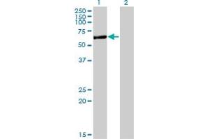Western Blot analysis of APPBP2 expression in transfected 293T cell line by APPBP2 monoclonal antibody (M09), clone 4C2. (APPBP2 抗体  (AA 486-585))