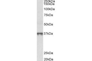 Western Blotting (WB) image for anti-Methionine Adenosyltransferase II, beta (MAT2B) (Isoform 1), (N-Term) antibody (ABIN2465101) (MAT2B 抗体  (Isoform 1, N-Term))