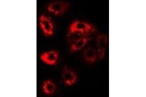 Immunofluorescent analysis of PSMD9 staining in Jurkat cells. (PSMD9 抗体)