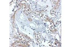 Immunohistochemistry of TNFAIP3 in human lung tissue with this product at 5 μg/ml. (TNFAIP3 抗体  (C-Term))