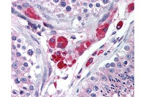 Anti-HIPK3 antibody IHC of human testis. (HIPK3 抗体  (AA 850-900))