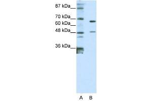Western Blot showing ZNF597 antibody used at a concentration of 1-2 ug/ml to detect its target protein. (ZNF597 抗体  (N-Term))