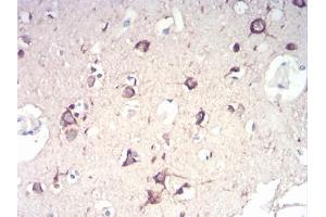 Immunohistochemistry (IHC) image for anti-Nuclear Factor of kappa Light Polypeptide Gene Enhancer in B-Cells Inhibitor, alpha (NFKBIA) (AA 150-291) antibody (ABIN5542657)