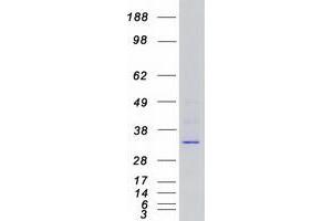 Western Blotting (WB) image for Cyclin-Dependent Kinase 6 (CDK6) protein (Myc-DYKDDDDK Tag) (ABIN2713868)