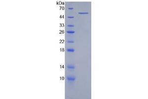 SDS-PAGE analysis of Human Integrin beta 2 Protein. (Integrin beta 2 Protein (ITGB2))