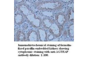 Image no. 1 for anti-Angiotensin II Receptor-Associated Protein (AGTRAP) (C-Term) antibody (ABIN791072)