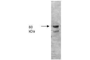 Image no. 1 for anti-Intestinal Alkaline Phosphatase (ALPI) antibody (ABIN799740) (Intestinal Alkaline Phosphatase 抗体)