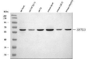 Western blot analysis of SETD3 using anti-SETD3 antibody (ABIN7600293).