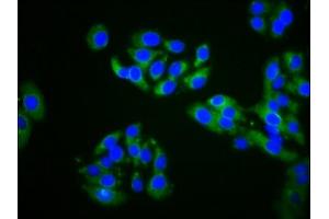 Immunofluorescence staining of HepG2 cells with ABIN7164570 at 1:200, counter-stained with DAPI. (ZDHHC14 抗体  (AA 328-453))