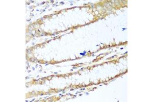 Immunohistochemistry of paraffin-embedded human stomach using MYH9 antibody. (Myosin 9 抗体)