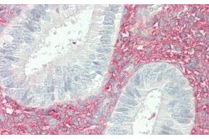 Immunohistochemistry (IHC) image for anti-Versican (Vcan) (AA 2958-3209) antibody (ABIN7434113)