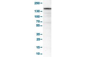 Western Blot analysis of RT-4 cell lysates with MKL2 monoclonal antibody, clone CL1546 . (MKL2 抗体  (AA 136-273))