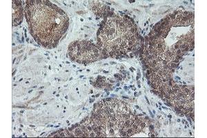 Image no. 3 for anti-Regulatory Factor X-Associated Ankyrin Containing Protein (RFXANK) antibody (ABIN1500685) (RFXANK 抗体)