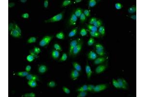 Immunofluorescence staining of Hela cells with ABIN7167994 at 1:250, counter-stained with DAPI. (ARHGEF7 抗体  (AA 1-250))