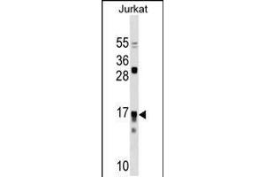Western blot analysis in Jurkat cell line lysates (35ug/lane). (IL17RC 抗体  (N-Term))
