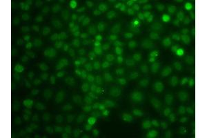 Immunofluorescence analysis of A549 cell using CBLC antibody. (CBLC 抗体)