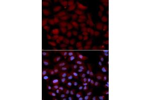 Immunofluorescence analysis of U2OS cell using TNK2 antibody. (TNK2 抗体  (AA 70-385))