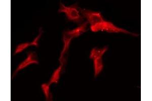 Immunofluorescence (fixed cells) (IF/ICC) image for anti-Solute Carrier Family 28 (Sodium-Coupled Nucleoside Transporter), Member 2 (SLC28A2) (Internal Region) antibody (ABIN6258323)