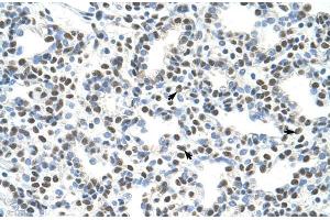 Human Lung; AKAP8L antibody - C-terminal region in Human Lung cells using Immunohistochemistry (AKAP8L 抗体  (C-Term))