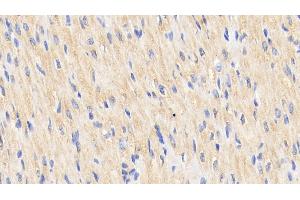 Detection of Hsp60 in Human Cardiac Muscle Tissue using Polyclonal Antibody to Heat Shock Protein 60 (Hsp60) (HSPD1 抗体  (AA 1-573))