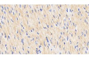 Detection of Hsp60 in Human Cardiac Muscle Tissue using Polyclonal Antibody to Heat Shock Protein 60 (Hsp60) (HSPD1 抗体  (AA 1-573))