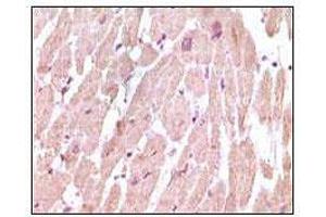Immunohistochemical analysis of paraffin-embedded human normal cardiac muscle tissue, showing cytoplasmic localization using cTnI mouse mAb with DAB staining. (TNNI3 抗体)