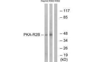 Western blot analysis of extracts from HepG2 cells and K562 cells, using PKA-R2β (Ab-113) antibody. (PRKAR2B 抗体  (Ser113))