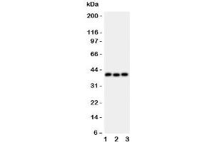 Western blot testing of WNT5A antibody and Lane 1:  HeLa;  2: MCF-7;  3: HT1080 lysate.
