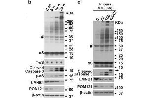 Western Blotting (WB) image for anti-POM121 Membrane Glycoprotein (POM121) (N-Term) antibody (ABIN2855297)