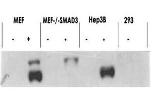 Western blot using SMAD3 (phospho S423/425) polyclonal antibody  shows detection of endogenous SMAD3 in stimulated cell lysates. (SMAD3 抗体  (pSer423, pSer425))